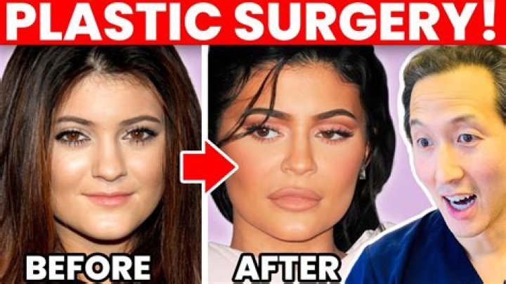 Kiefer Sutherland: The Transformation Through Plastic Surgery